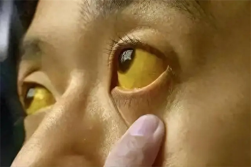 图片说明